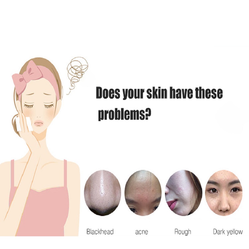 Deep Cleansing Estoliators Trẻ hóa mặt Nâng cơ mặt Siêu âm Scrubber